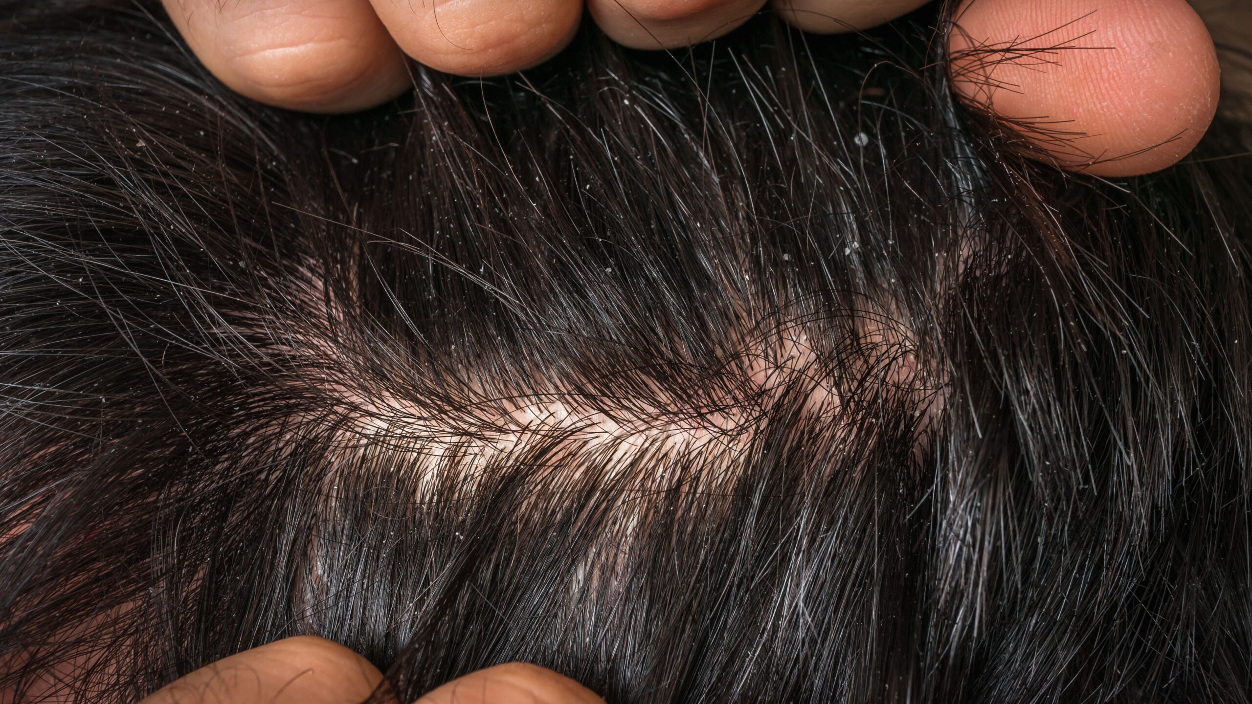 Does Using Body Wash as Shampoo Damage Your Hair?
