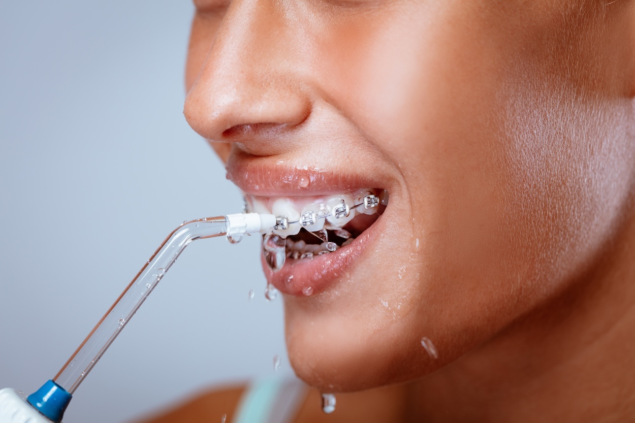 Best Mouth Wash for Bad Breath with Braces
