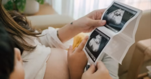 What Is Sperm DNA Fragmentation and Does It Cause Miscarriage?